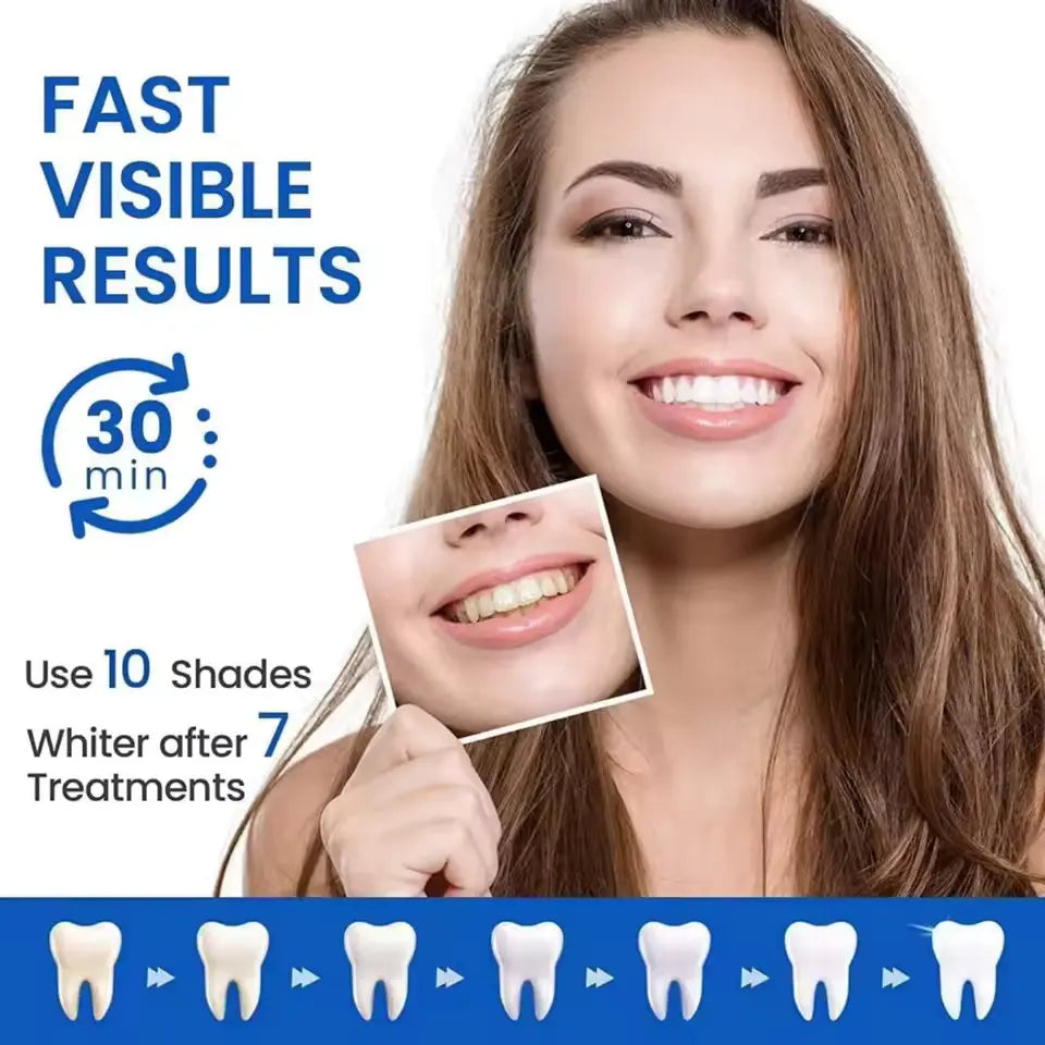 Bright Smile Whitening Strips